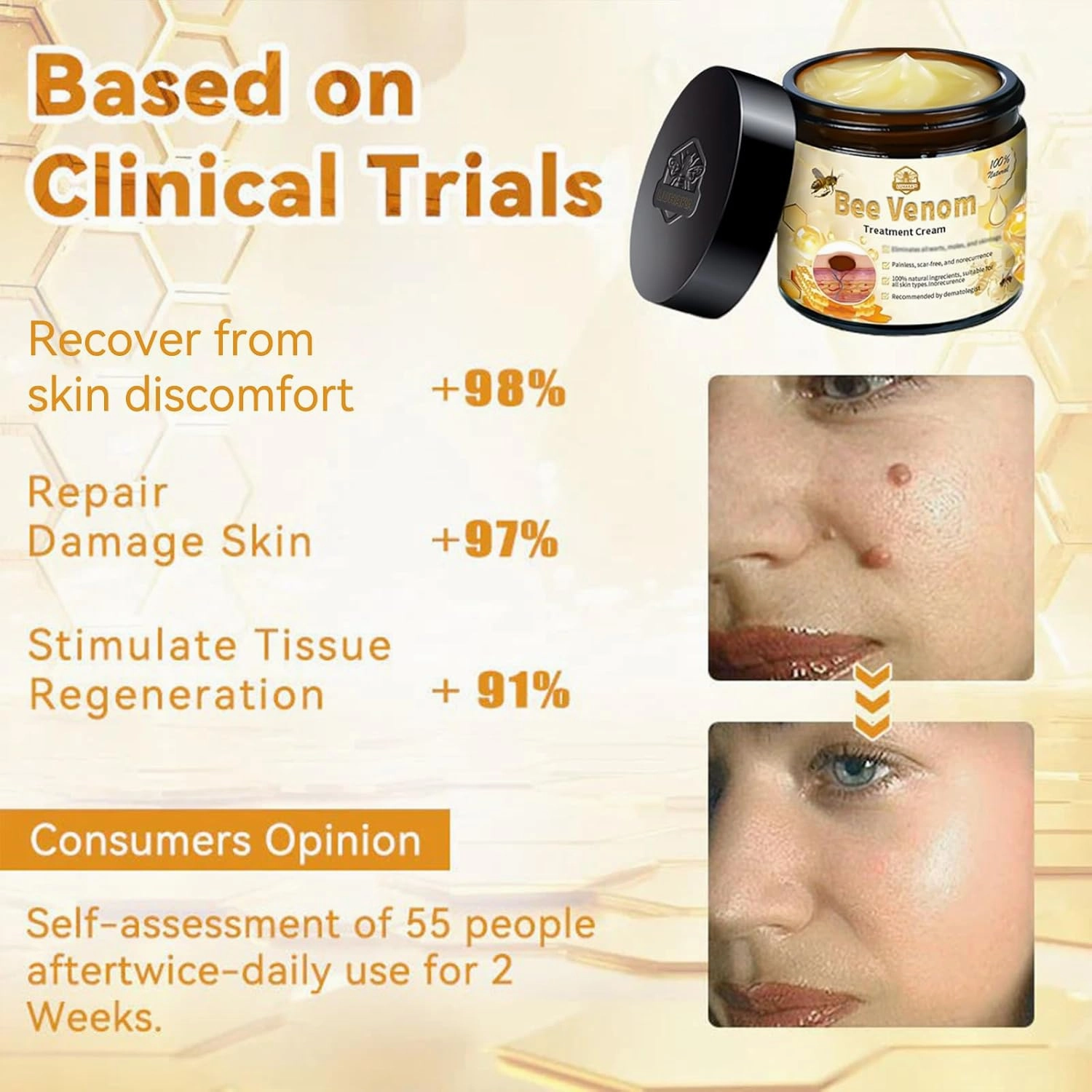 Bee Venom Skin Treatment Cream,LUHAKA Bee Venom Cream, 2024 New Bee Venom Treatment Cream,Bee venom cream for skin repair (3)