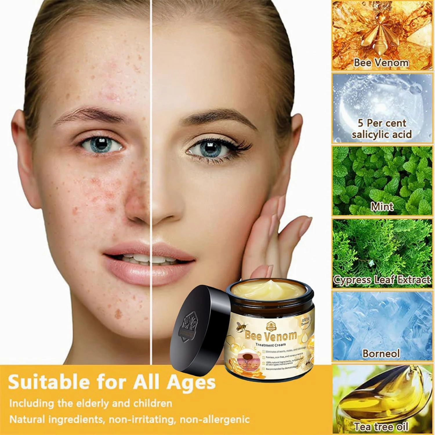 Bee Venom Skin Treatment Cream,LUHAKA Bee Venom Cream, 2024 New Bee Venom Treatment Cream,Bee venom cream for skin repair (3)