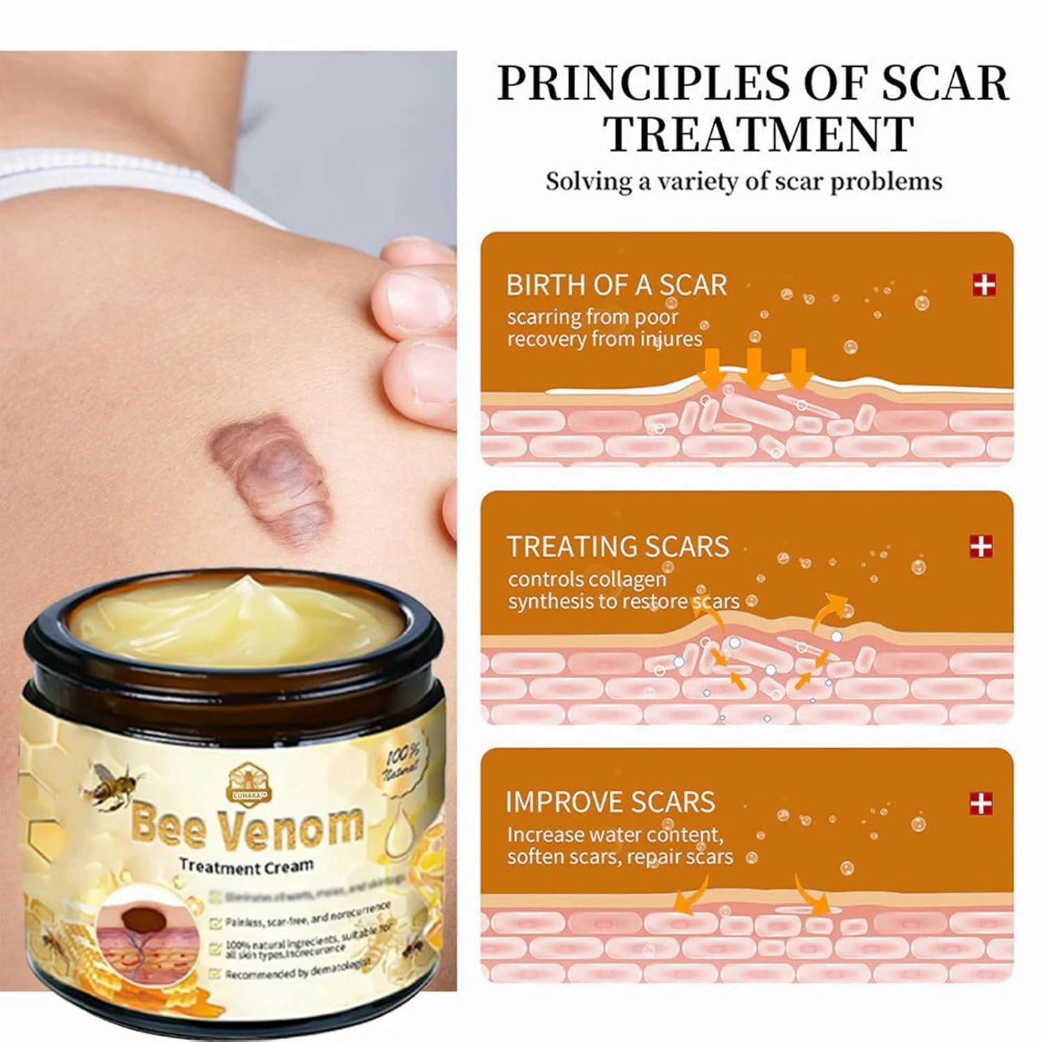 Bee Venom Skin Treatment Cream,LUHAKA Bee Venom Cream, 2024 New Bee Venom Treatment Cream,Bee venom cream for skin repair (3)